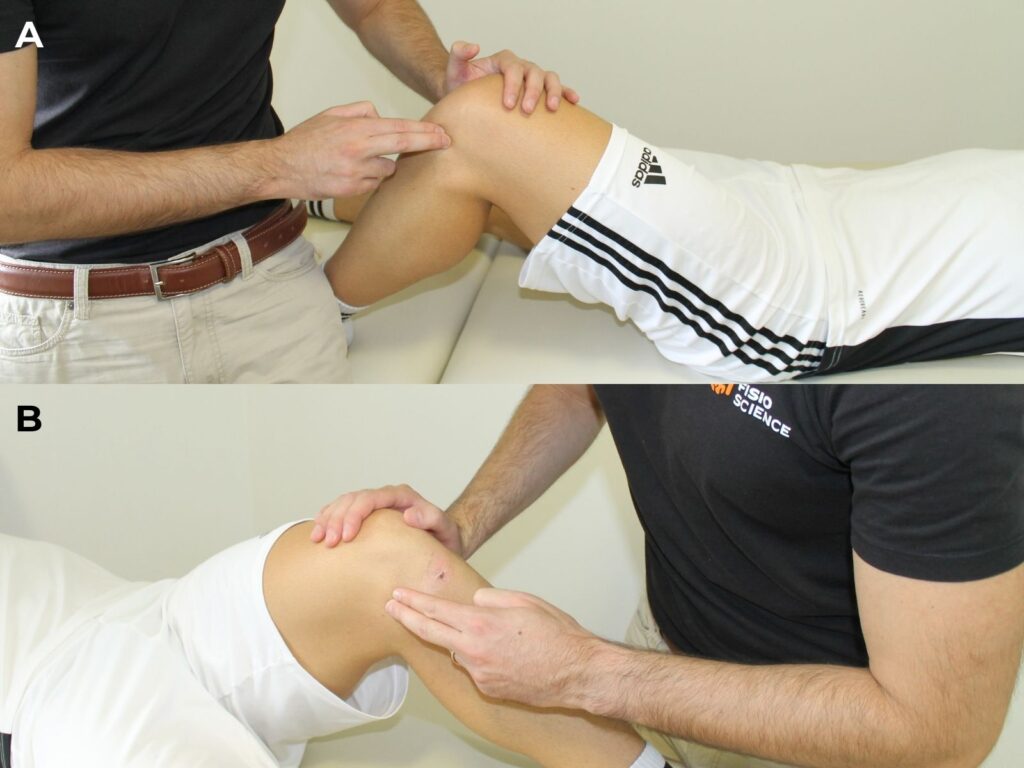 lesioni meniscali: test