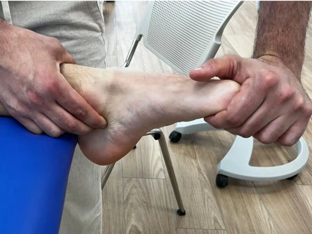 sindrome del tunnel tarsale: triple compression test