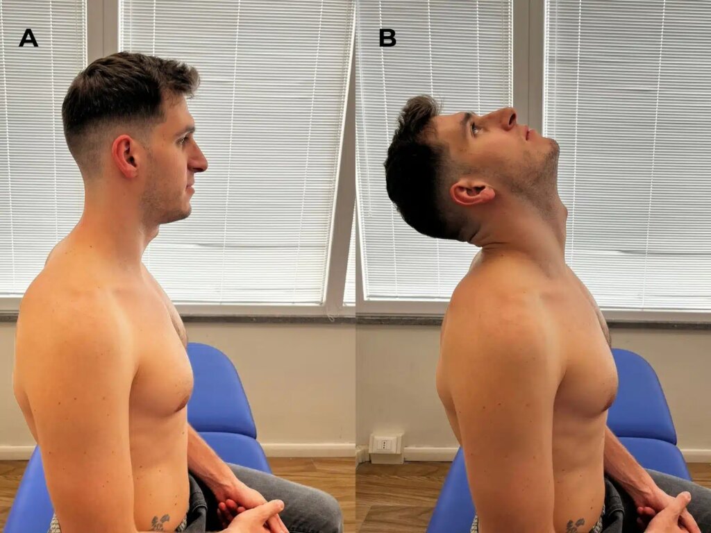 Neck Pain Aspecifico: rom