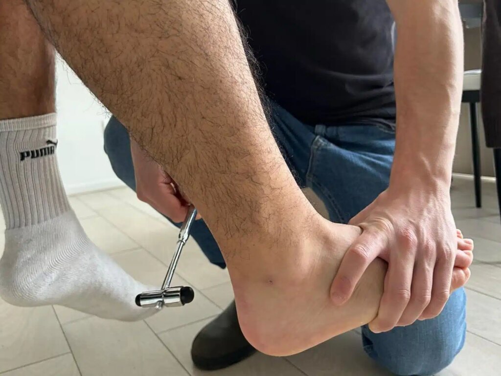 Sindrome della cauda equina: riflesso achilleo