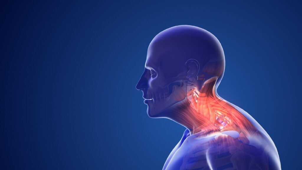 Text neck muscolatura cervicale
