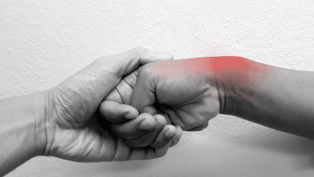 Sindrome di De Quervain: test di Eichoff