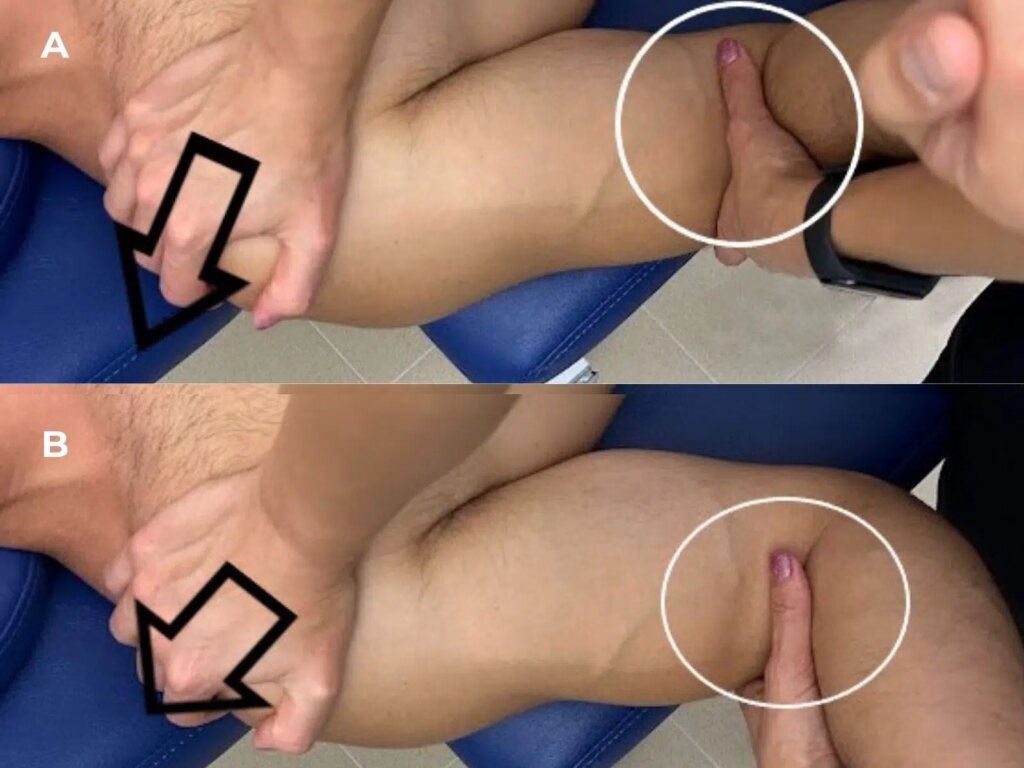 frozen shoulder: Glide AP