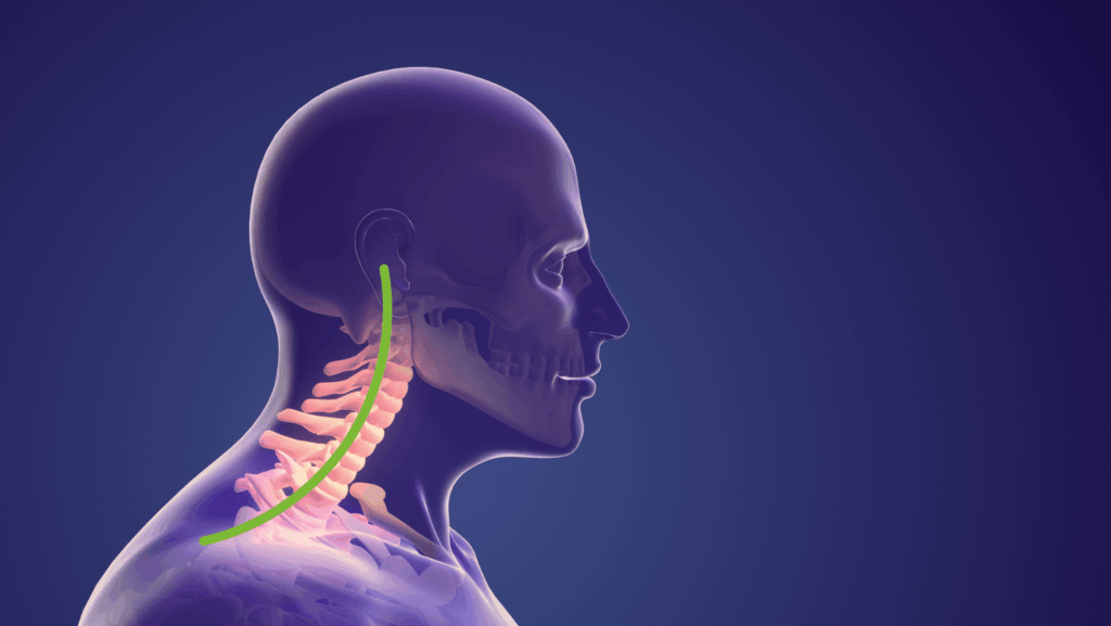 Malocclusione e postura: lordosi cervicale