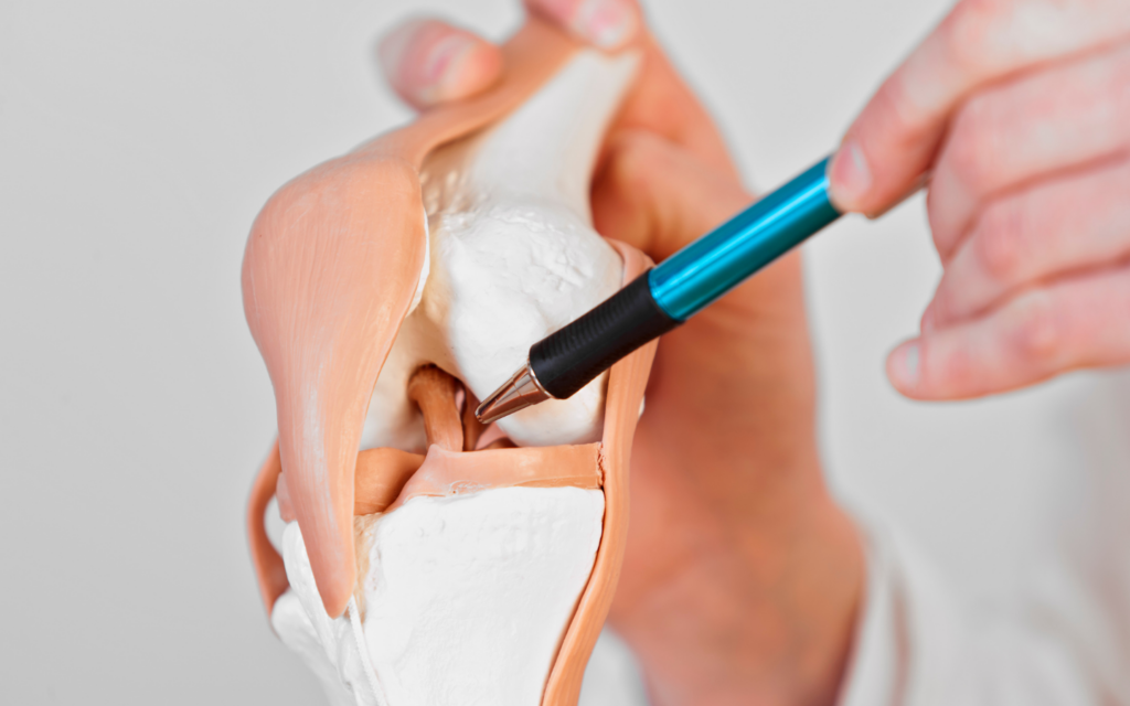 ACL-RSI