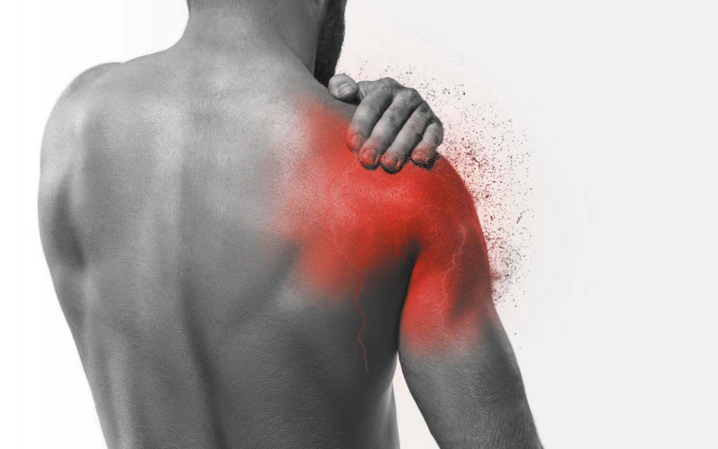 Oxford Shoulder Score