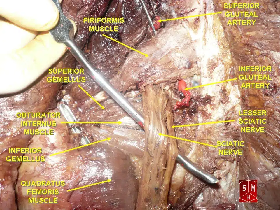 Sindrome del piriforme: anatomia