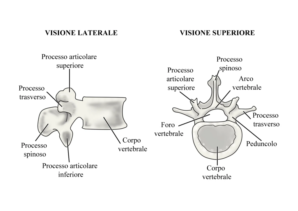 Spondilolisi: vertebra lombare