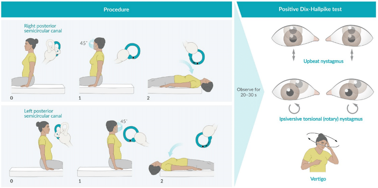 dizziness e vertigini: valutazione