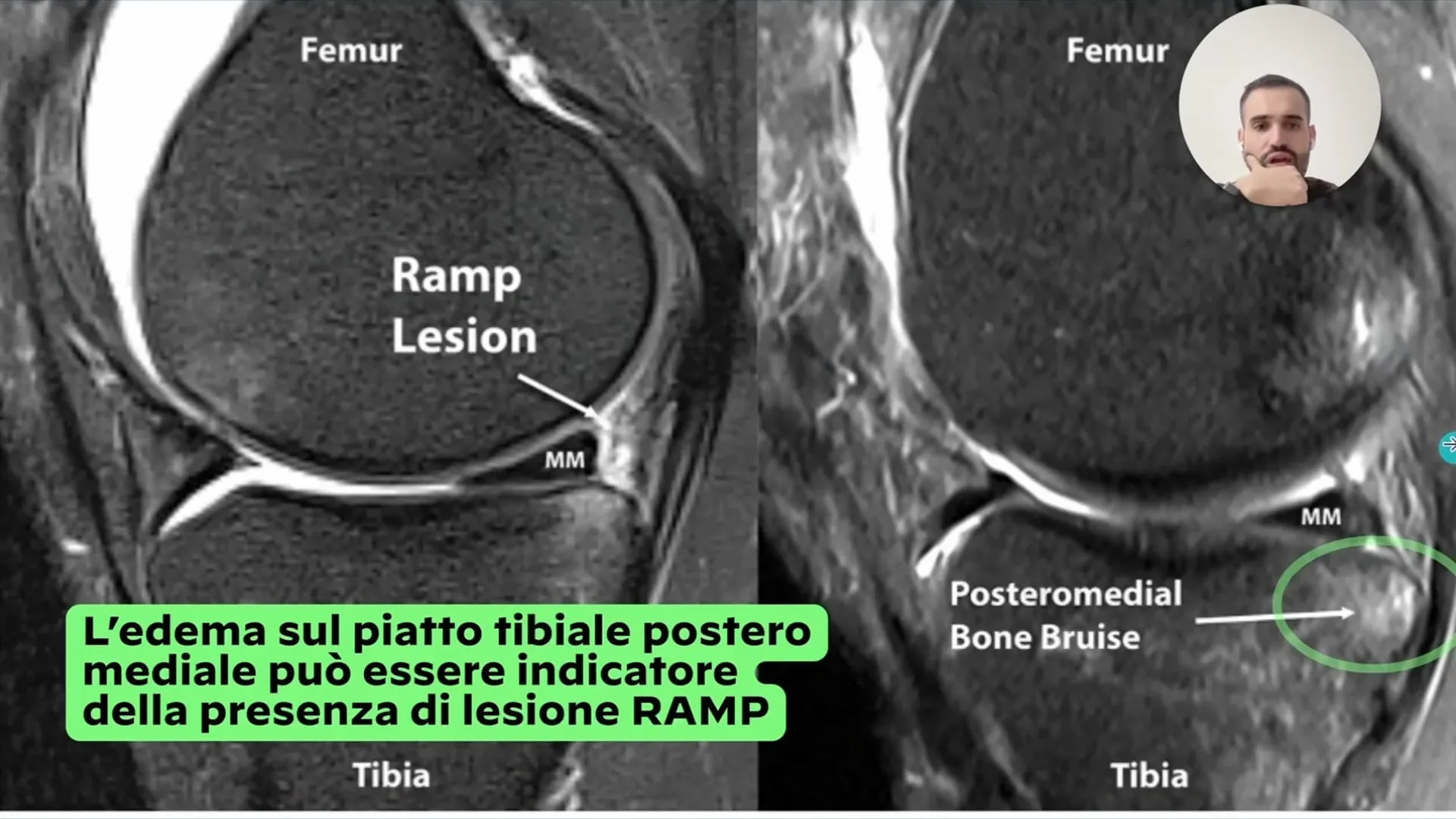 club-video-lesioni-traumatiche