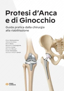 Copertina del libro Protesi d'anca e di ginocchio - FisioScience